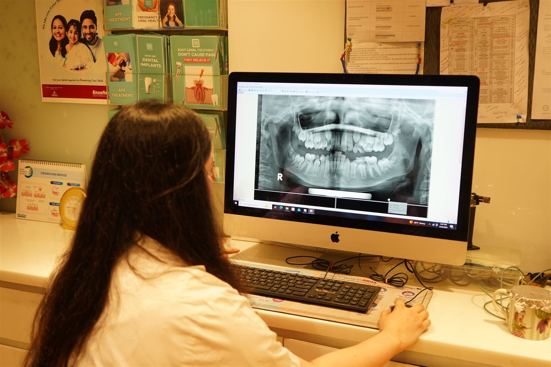 Digital X-Ray Analysis
